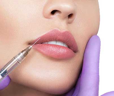 Lip filler